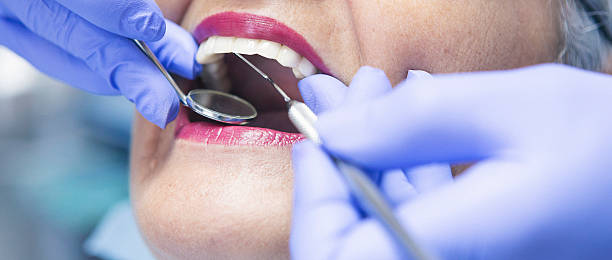Best Emergency Tooth Extraction in Antlers, OK